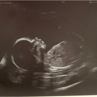 Babylist Registry Photo.