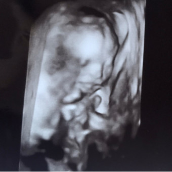 Babylist Registry Photo.