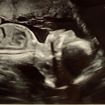 Babylist Registry Photo.