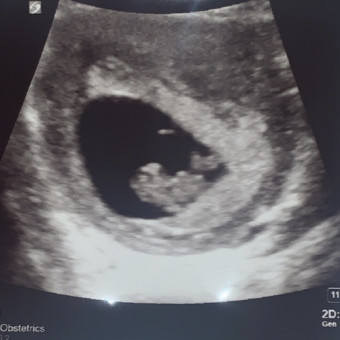 Babylist Registry Photo.