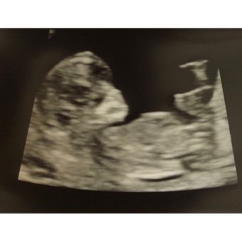 Babylist Registry Photo.