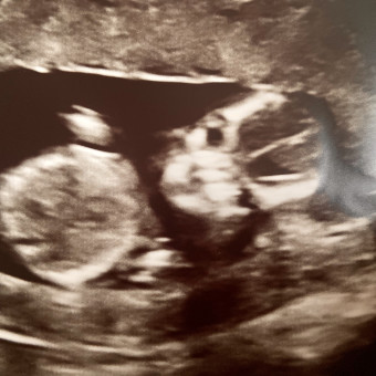Babylist Registry Photo.