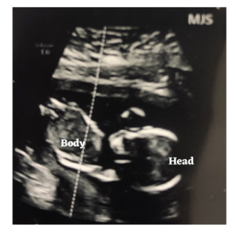 Babylist Registry Photo.
