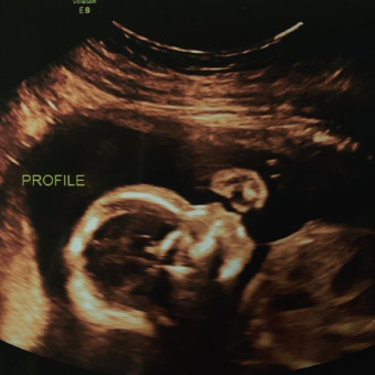 Babylist Registry Photo.