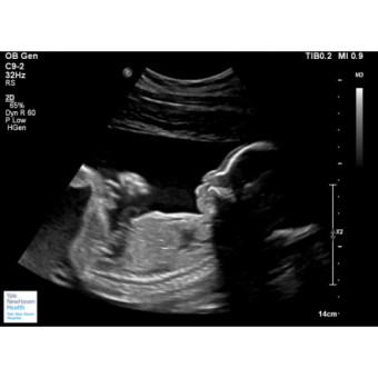 Babylist Registry Photo.