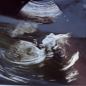 Babylist Registry Photo.