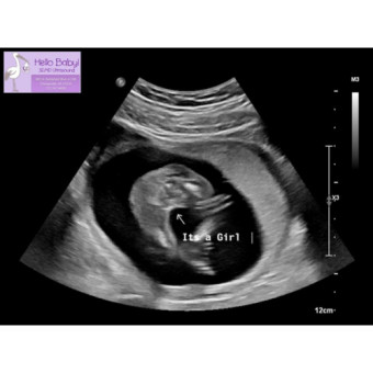 Babylist Registry Photo.
