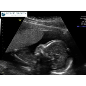 Babylist Registry Photo.