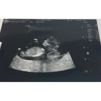 Babylist Registry Photo.