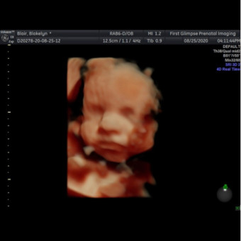 Babylist Registry Photo.