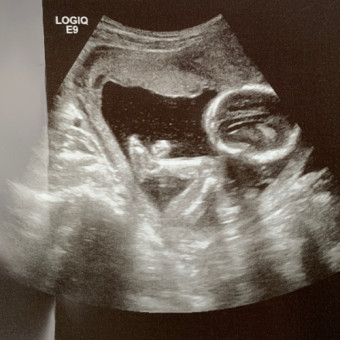 Babylist Registry Photo.