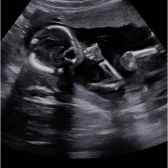 Babylist Registry Photo.