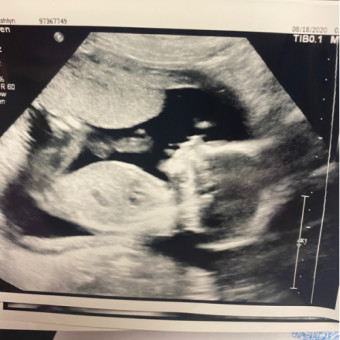 Babylist Registry Photo.
