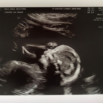 Babylist Registry Photo.