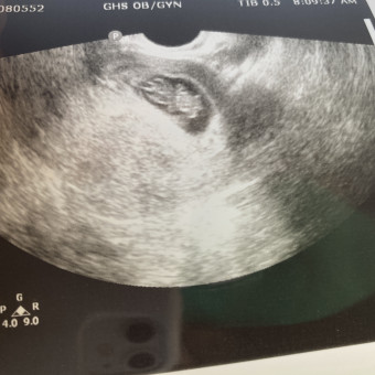 Babylist Registry Photo.