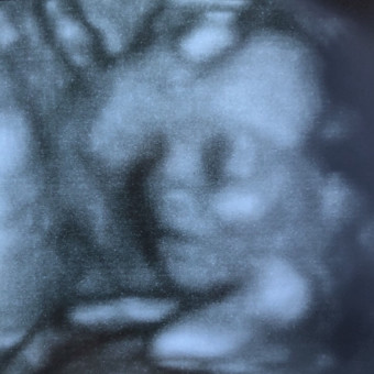 Babylist Registry Photo.