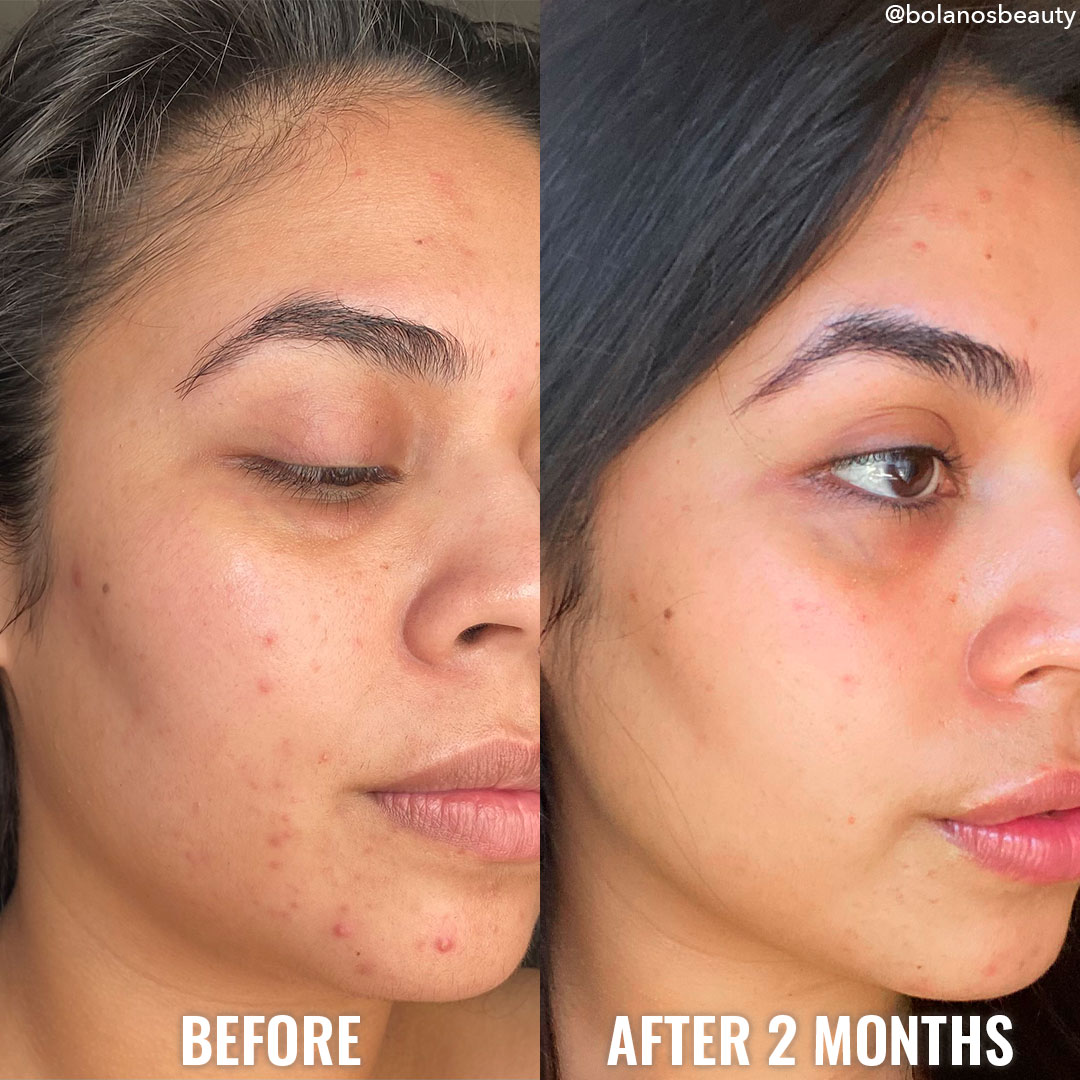 see a difference in your skin