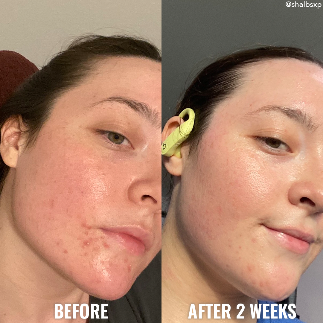 see a difference in your skin