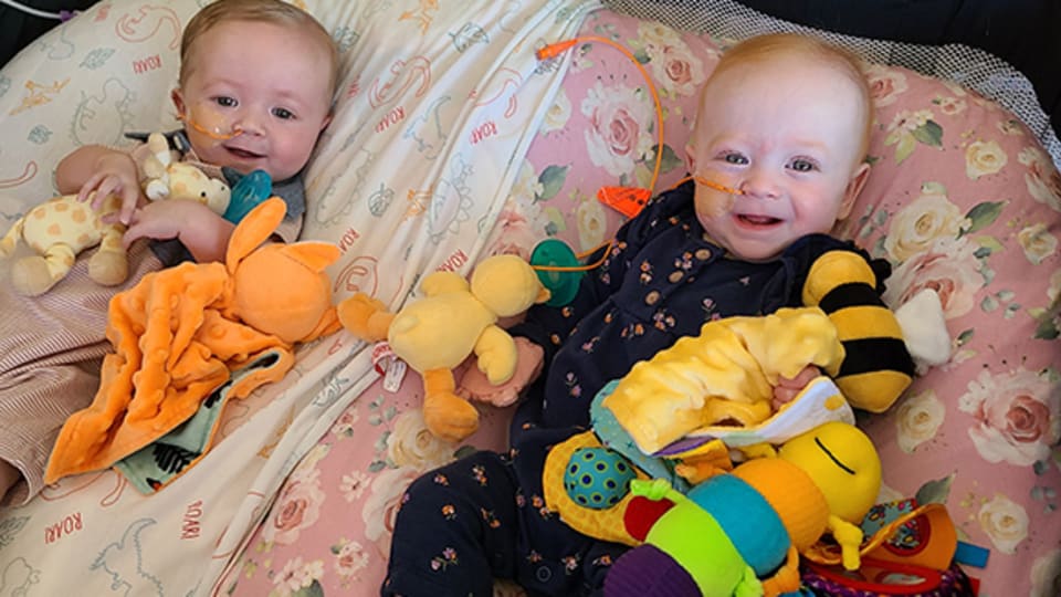 Twin patients with congenital heart defects
