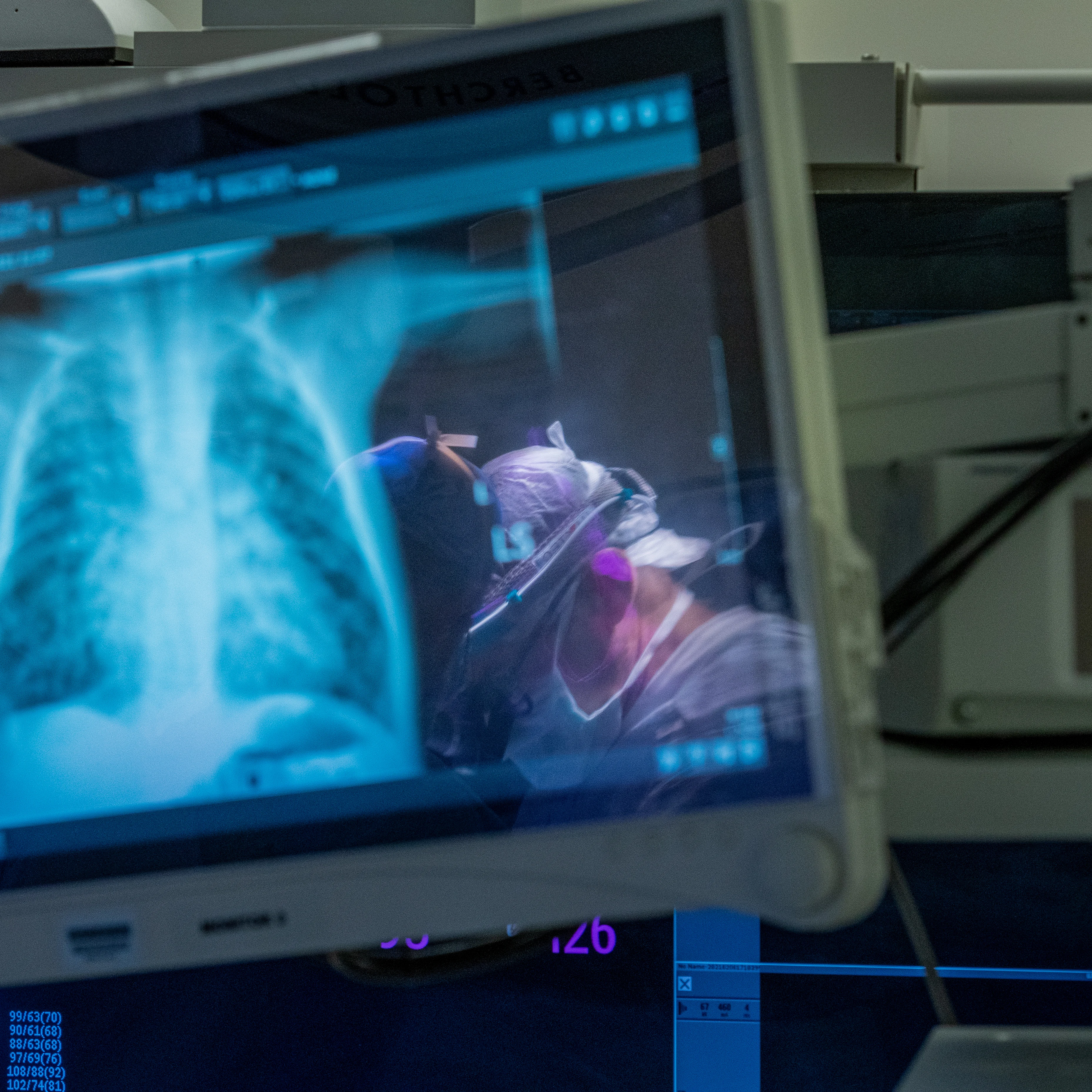 pediatric heart surgeons seen through the patient's reflection of an x-ray on a monitor.