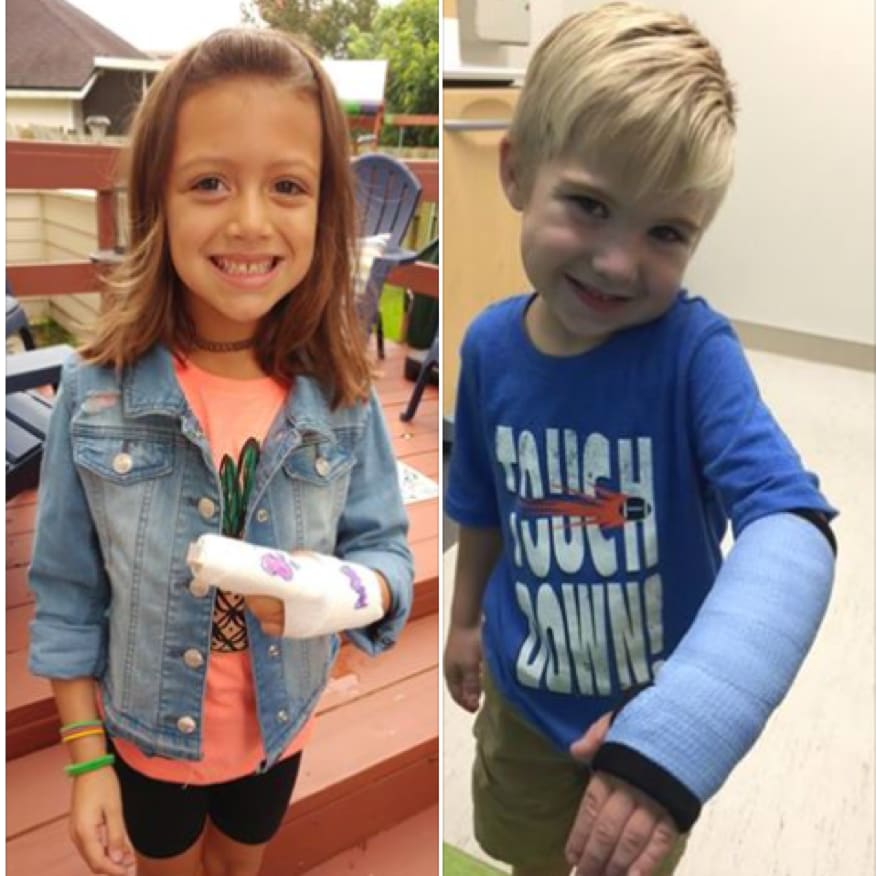 two smiling children with casts on the left is a little girl with her finger in a cast and on the right is a little boy with his arm in a cast