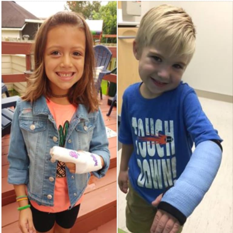 two smiling children with casts on the left is a little girl with her finger in a cast and on the right is a little boy with his arm in a cast