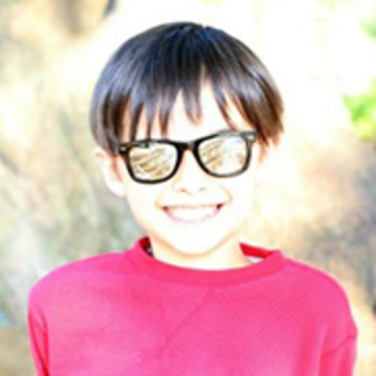 Arteriovenous malformation patient Caleb