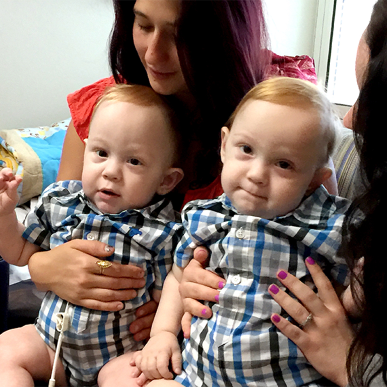 Formerly conjoined twin boys Carter and Conner