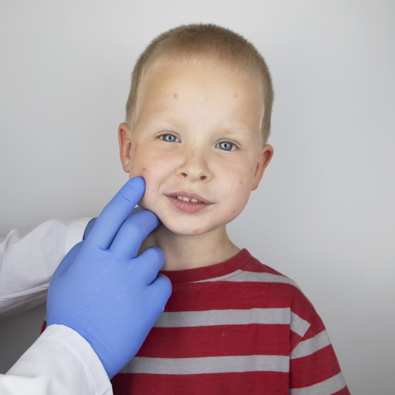 Pediatric dermatology patient
