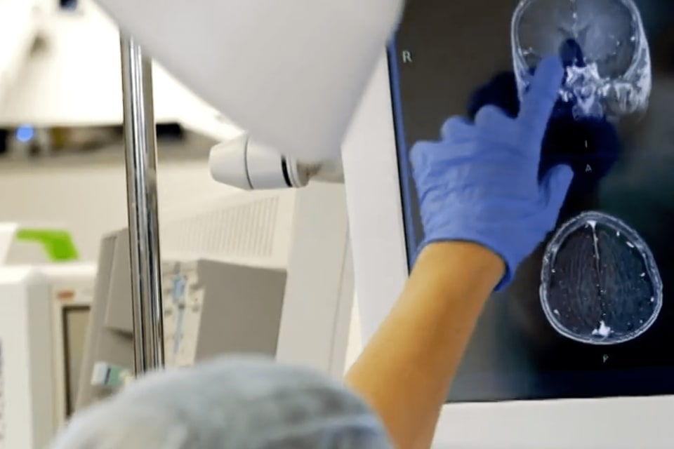 close up of a technician's hand pointing to a brain scan on a monitor