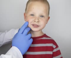 Wolfson Children's Pediatric Dermatology Services