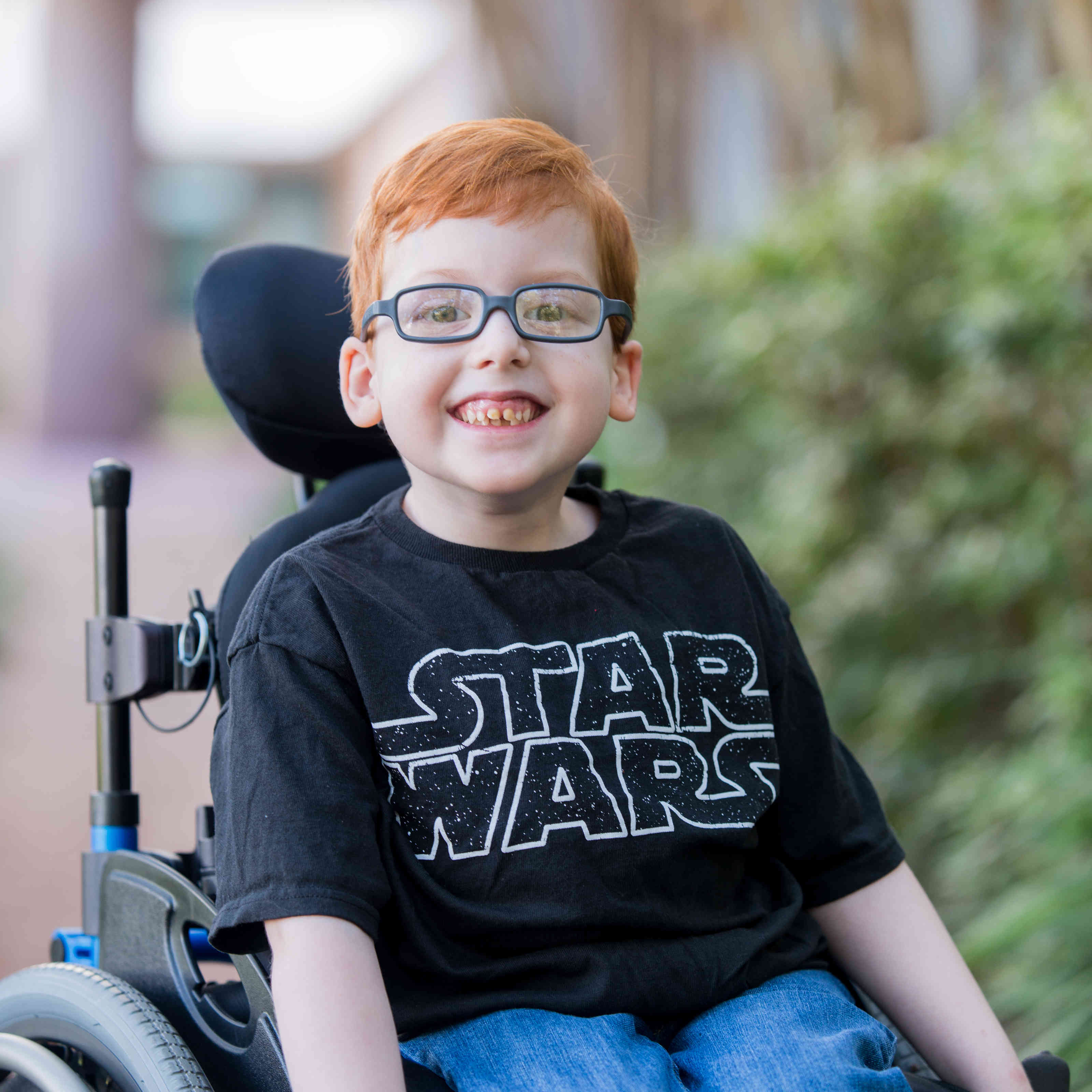 Wolfson Children's Hospital Spine Defects