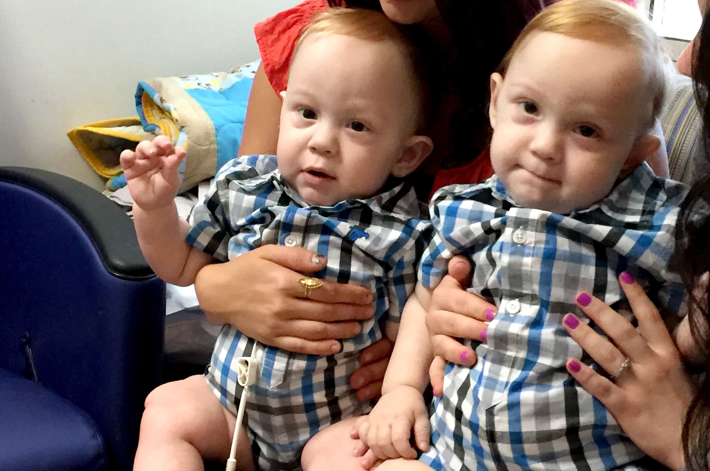 Wolfson Children's Hospital Twins Newborn Story