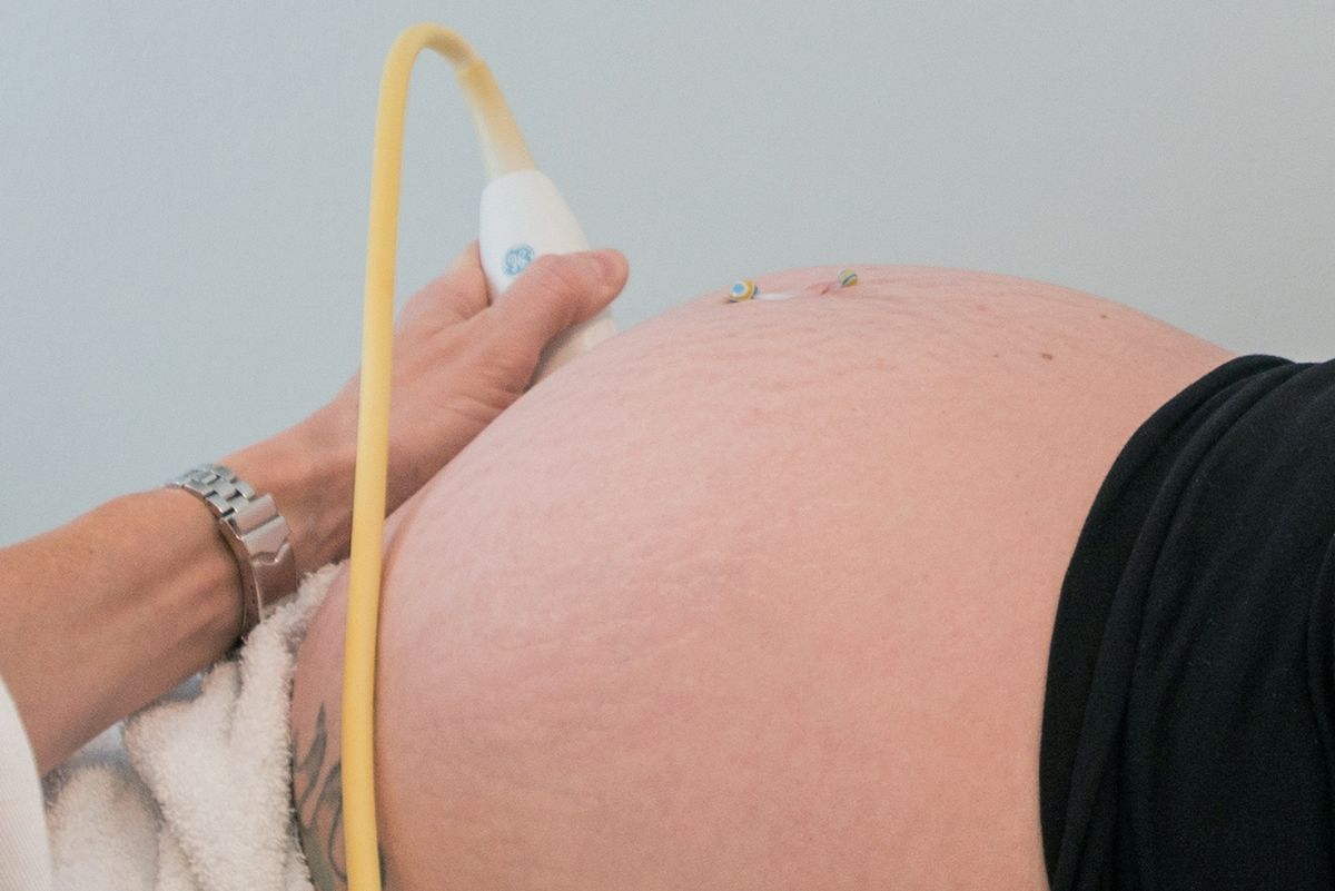 Wolfson Children's Hospital Fetal Cardiac Care