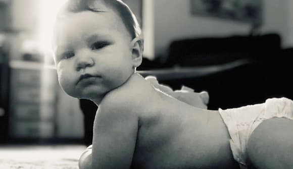 baby has surgery for heart defect