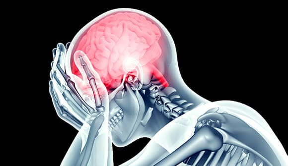photo for Strong ties to stroke article
