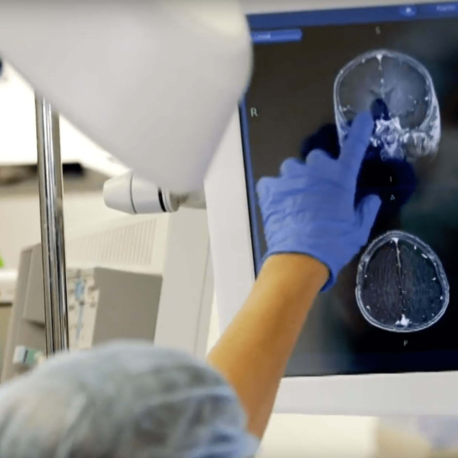 close up of a technician's hand pointing to a brain scan on a monitor