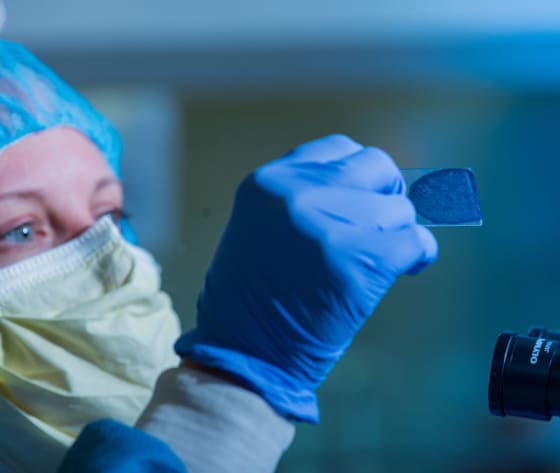 A close up of a microscope slide with cancer cells, held by a researcher wearing gloves and mask.