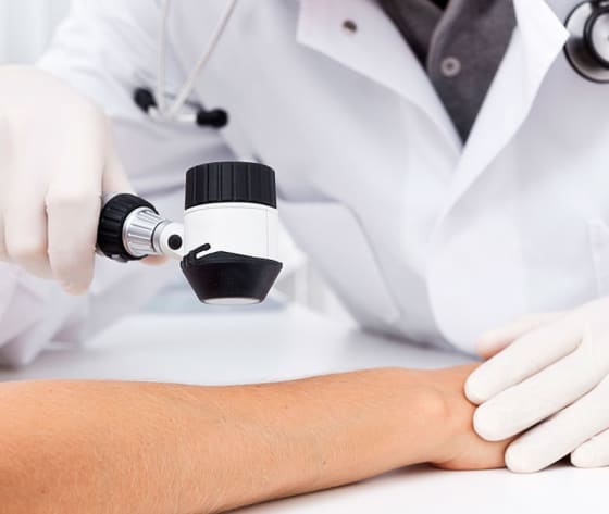 A closeup of a medical magnifying tool examining a person's arm.