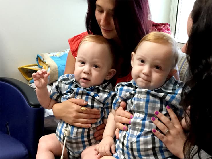 Wolfson Children's Hospital Twins' Newborn Story