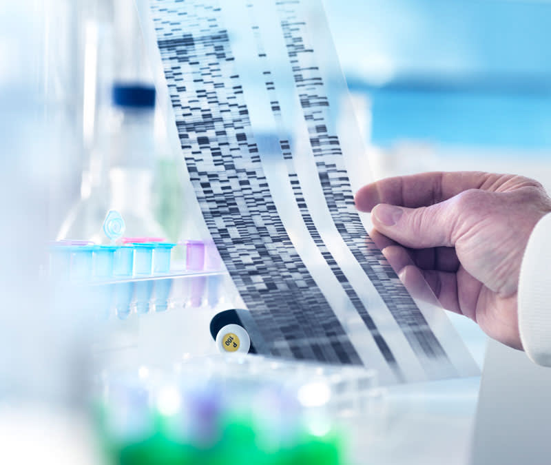 Cropped hands of scientist holding DNA gel in laboratory as part of genetic counseling and breast cancer early detection.