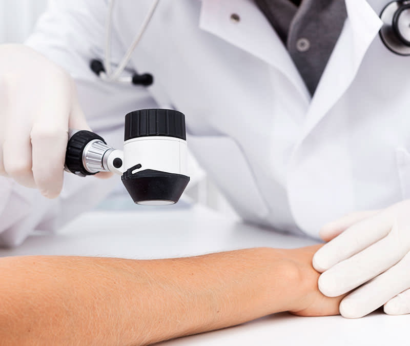 A closeup of a medical magnifying tool examining a person's arm.