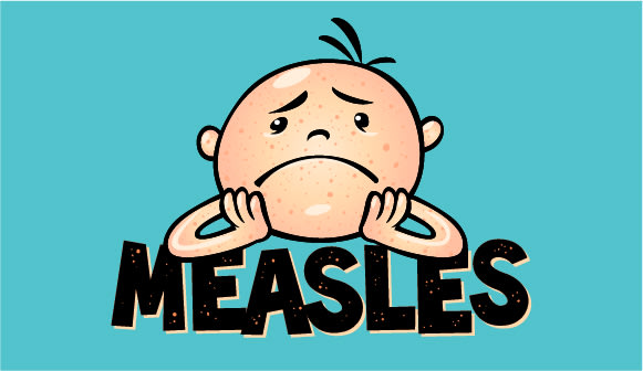 graphic of a child with measles with the text "MEASLES" underneath him