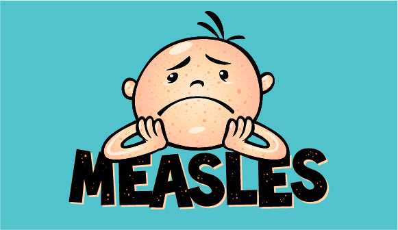 Measles is back