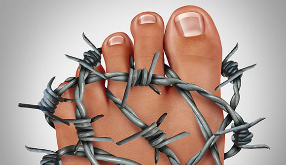 Graphic depicting a muscle cramp with barbed wire around a foot