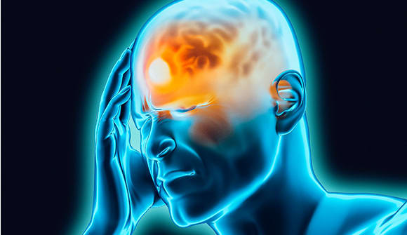 Migraines cause severe pain in your head.