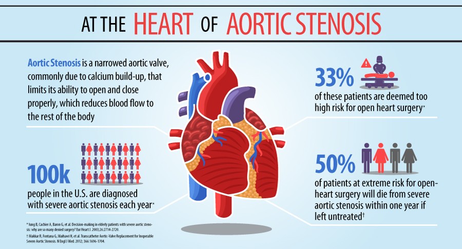 Aortic Stenosis