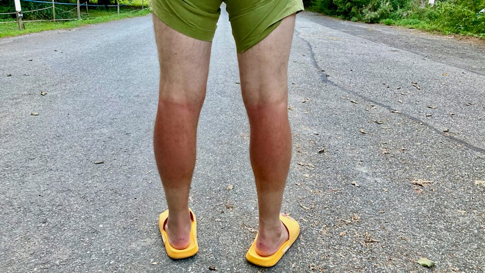 A man with sunburn on his legs is wearing yellow flip flops.