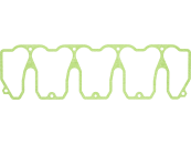 Fendt Ventildeckeldichtung f&uuml;r KHD-Motor Traktor Deutz-Fahr Agrotron, Fendt Farmer 300, F119200210380 