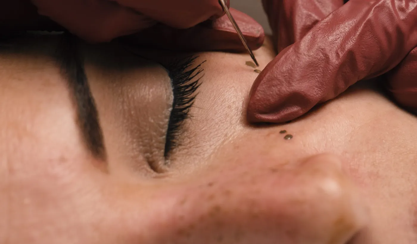 micropigmentación facial fallida